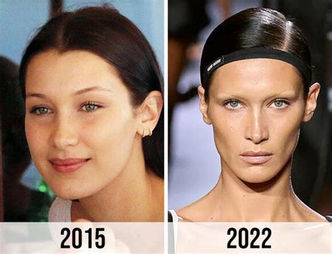 bella hadid buccal fat removal|Bella Hadid Plastic Surgery: Which 5 Surgeries Did。